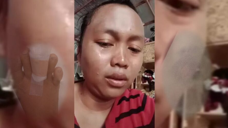 TKW asal Banten Disiksa Majikan di Arab Saudi TKW asal Banten Disiksa Majikan di Arab Saudi